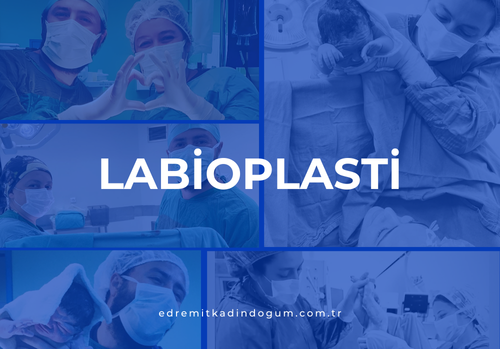 Labioplasti